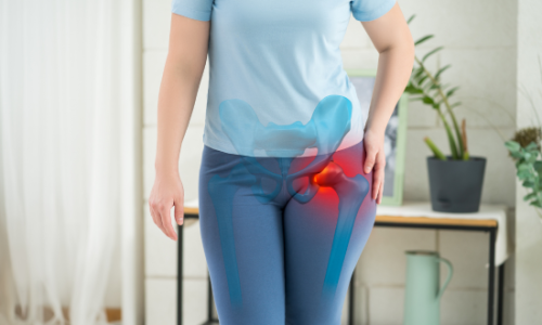 hip replacement hip replacement
